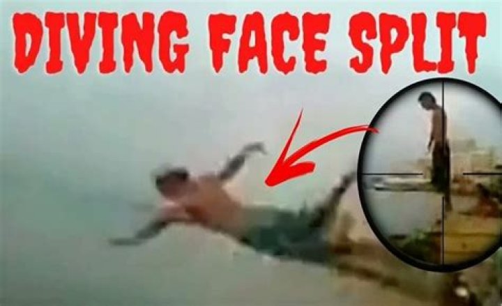 (Leaked) Face Split Diving Accident Video Viral On Twitter and Reddit