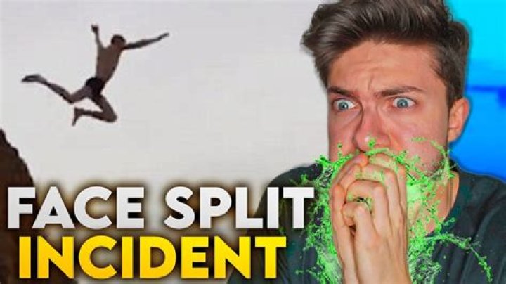 Man Splits Face Open Diving Video worthykeen