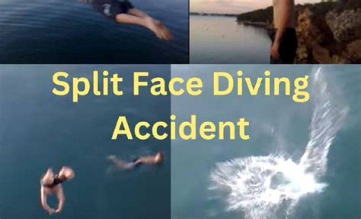 Split Head Diving Accident IT'S A 2009 VIRAL VIDEO 😱Split Face